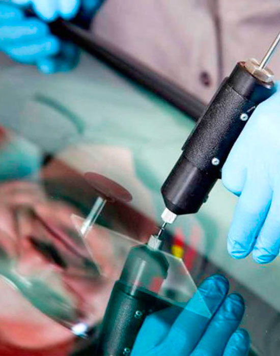 Ремонт сколов Теплый стан